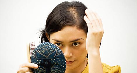 En hel del sjukdomar i hår och hårbotten finns det hjälp mot, så det allra första man ska göra om man får kala fläckar i hårbotten är att söka hjälp inom vården för att få rätt diagnos.